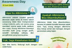 Selamat Hari Albinisme Sedunia 🧬