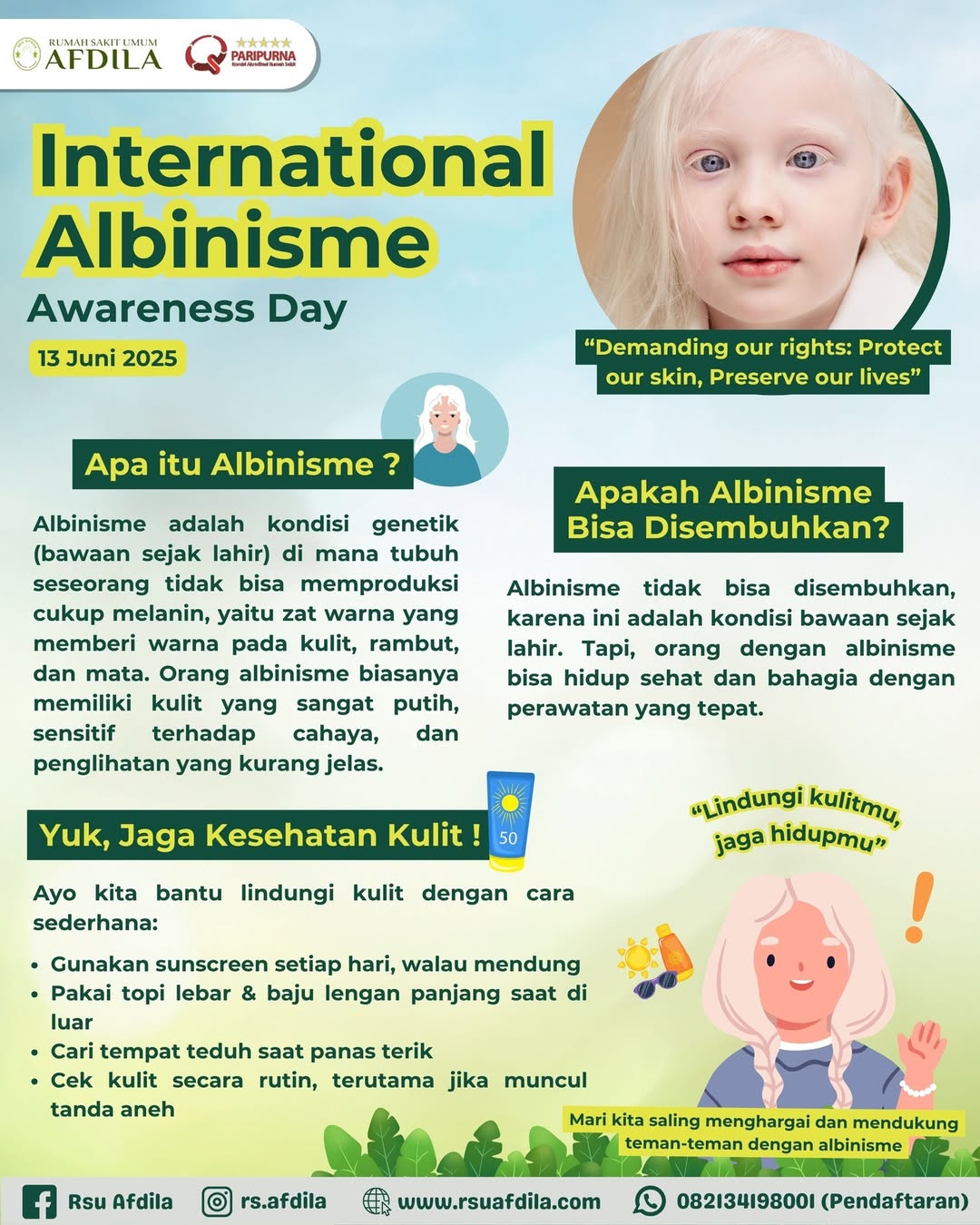 Selamat Hari Albinisme Sedunia 🧬